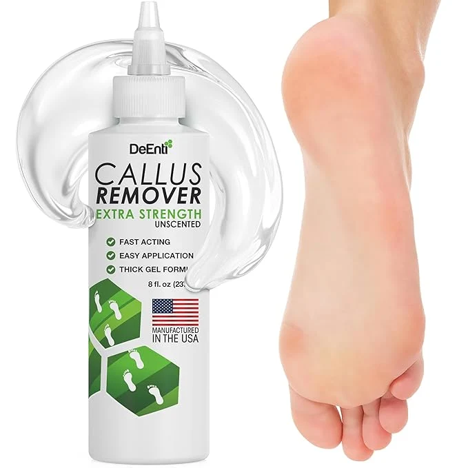 Specialty DeEnti Callus Remover for Feet Extra Strength Foot Callus Remover Gel Top-Quality